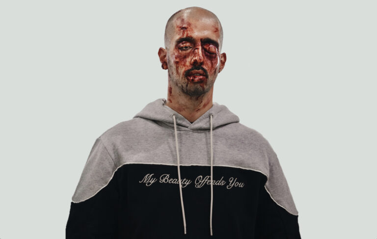 Unfair - Profilepicture