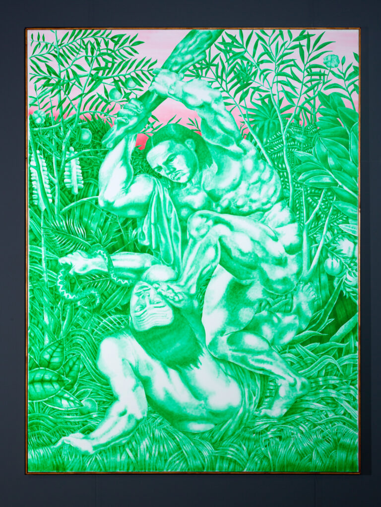 Unfair - Koos_devries_i constantly complain about the pain i'm in 1_2024